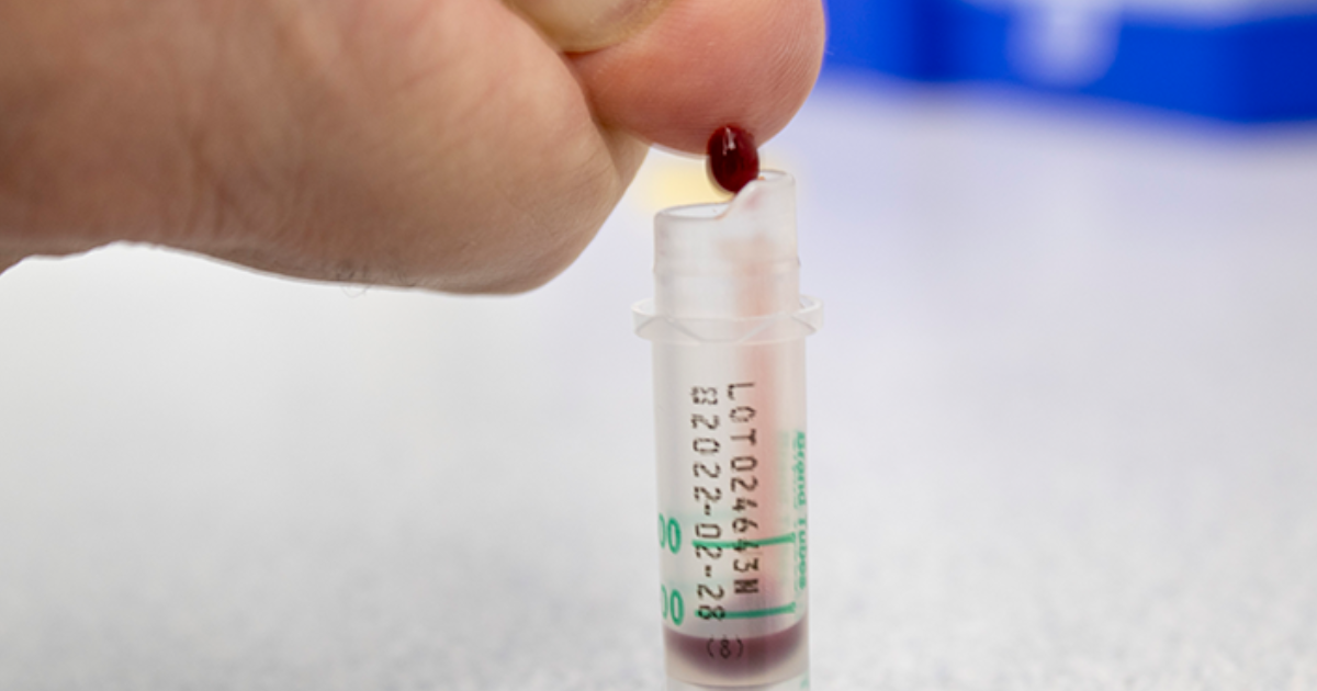 Complete Blood Count with Differential (CBC w/diff)